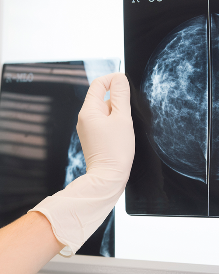 Woman-reviewing-mammogram