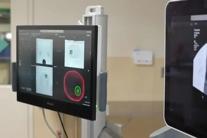 UroNav machine with scan on screen